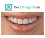 Straight My Teeth
